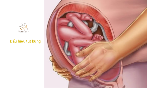 dau hieu sap sinh tut bung