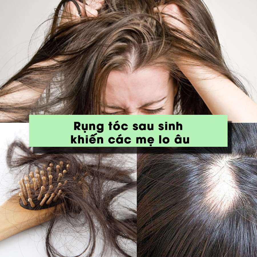 10 cách giảm rụng tóc, giúp ngăn ngừa tóc rụng hiệu quả tại nhà