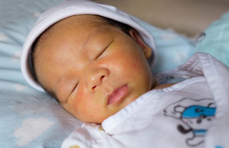 Vàng Da Ở Trẻ Sơ Sinh: Cẩm Nang Toàn Diện Dành Cho Cha Mẹ