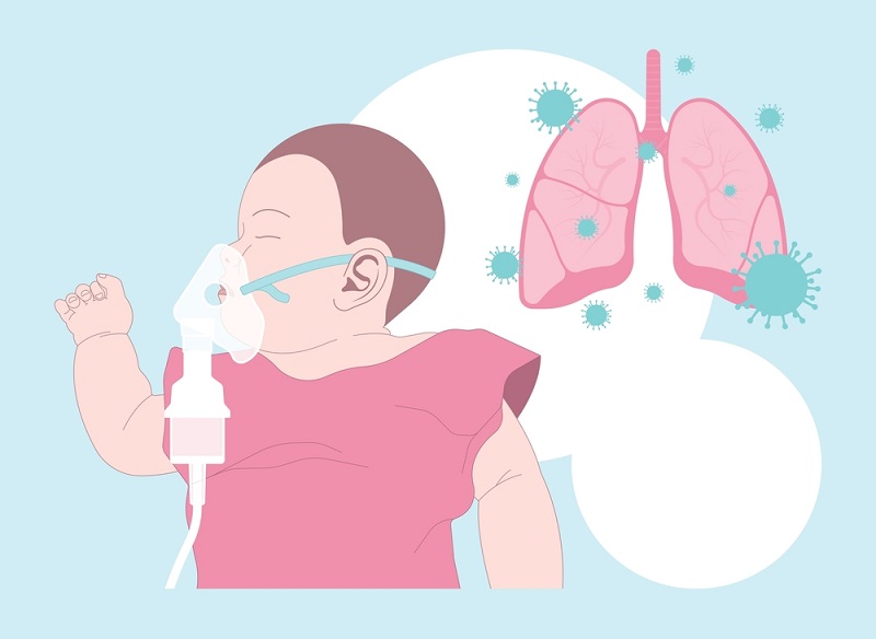 Bé Sơ Sinh Bị Viêm Đường Hô Hấp Cấp: Nhận Biết Sớm, Chăm Sóc Đúng Cách Bé Sơ Sinh Bị Viêm Đường Hô Hấp Cấp: Nhận Biết Sớm, Chăm Sóc Đúng Cách