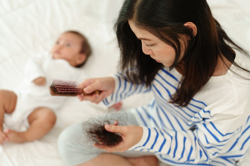 Rụng Tóc Sau Sinh