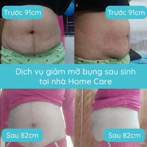 dich-vu-giam-mo-bung-giam-eo-sau-sinh-tai-nha-home-care2