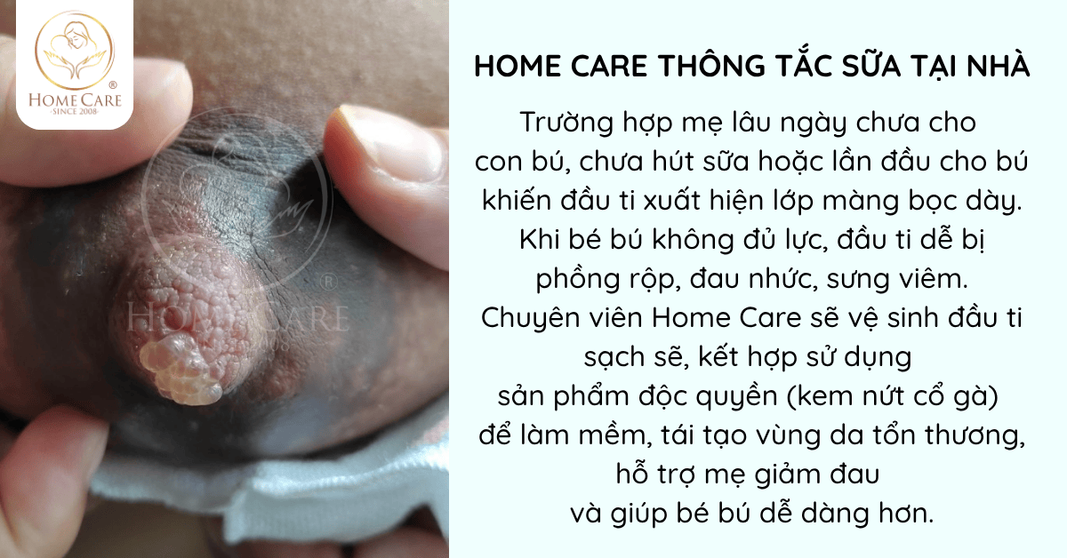 dich-vu-thong-tac-sua-tai-nha-homecare