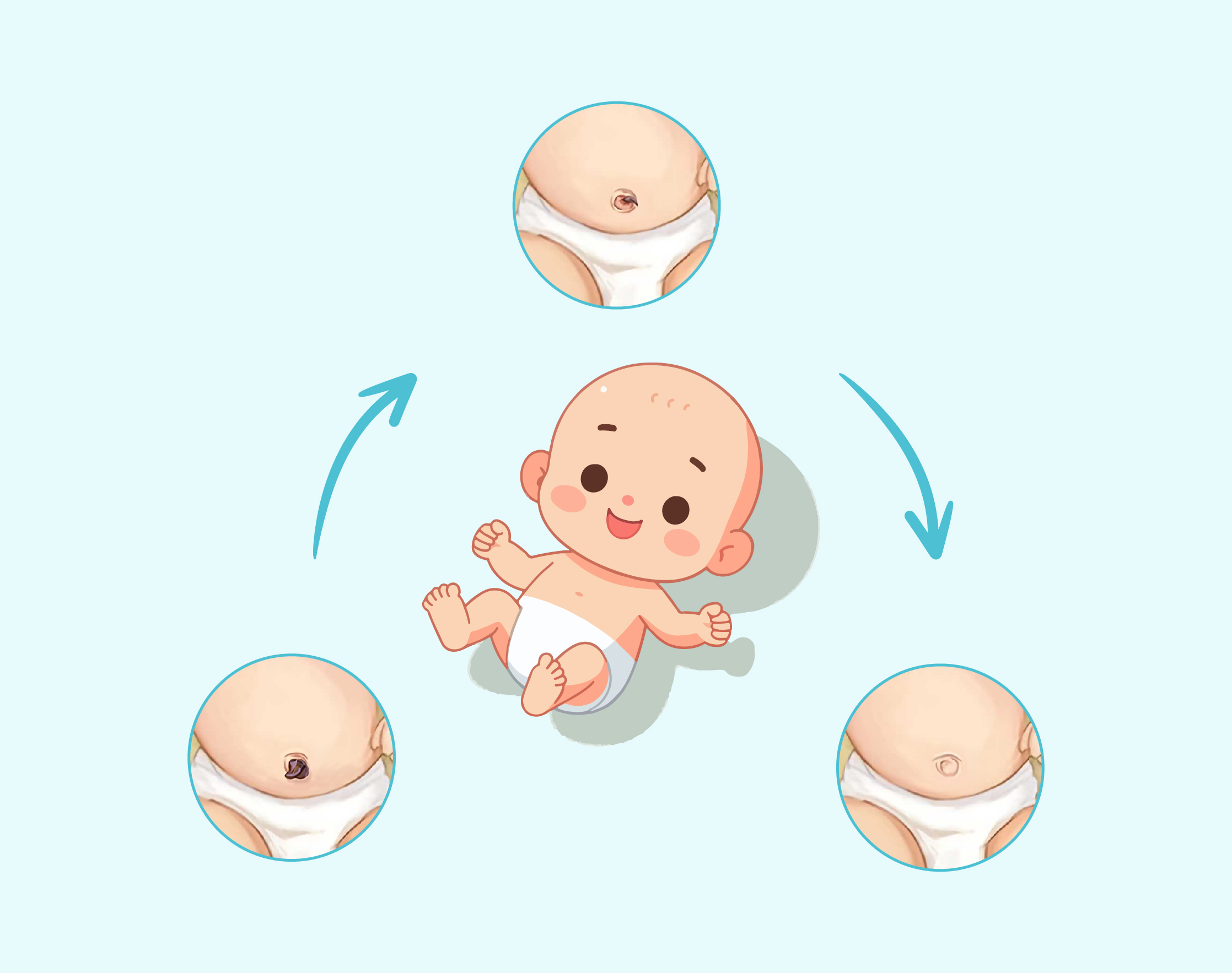 Dịch vụ chăm sóc rốn cho bé