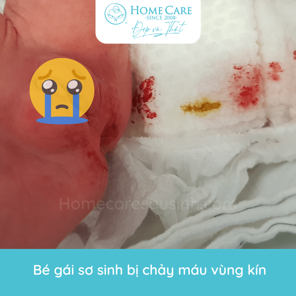 be-gai-so-sinh-chay-mau-vung-kin-min
