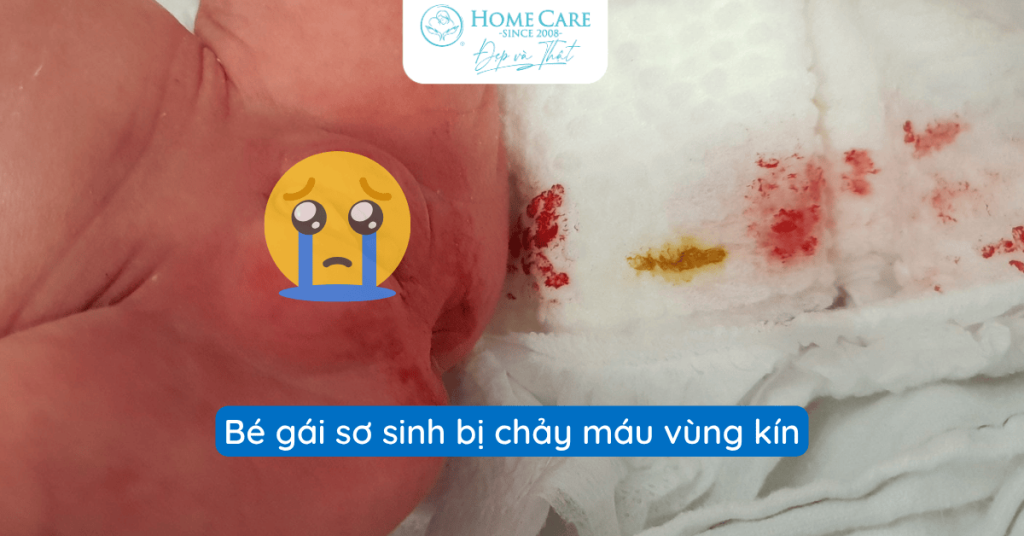 Mẹ ơi, đừng chủ quan nếu bé gái sơ sinh chảy máu vùng kín quá 3 ngày!