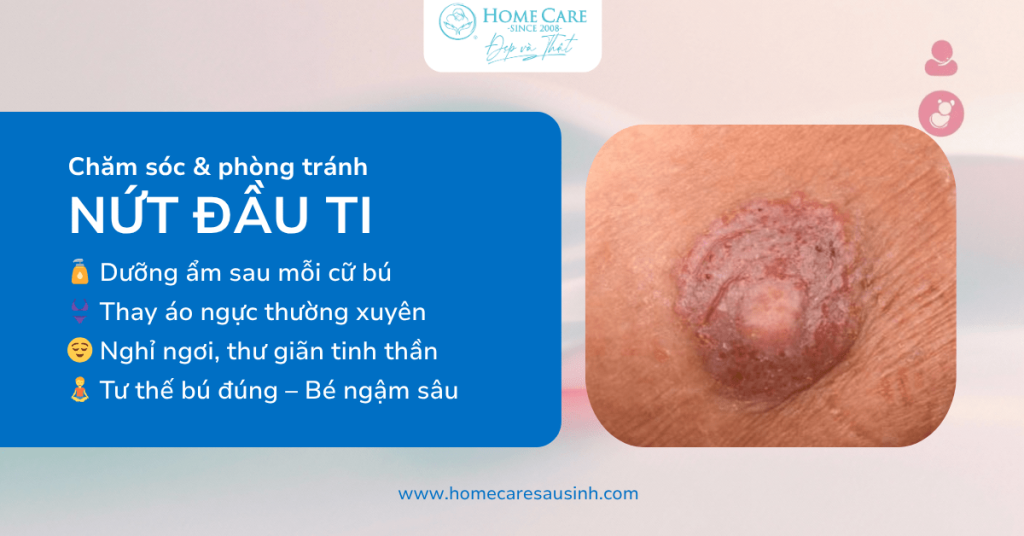 chamsoc-phong-tranh-nut-dau-ti-sau-sinh-min