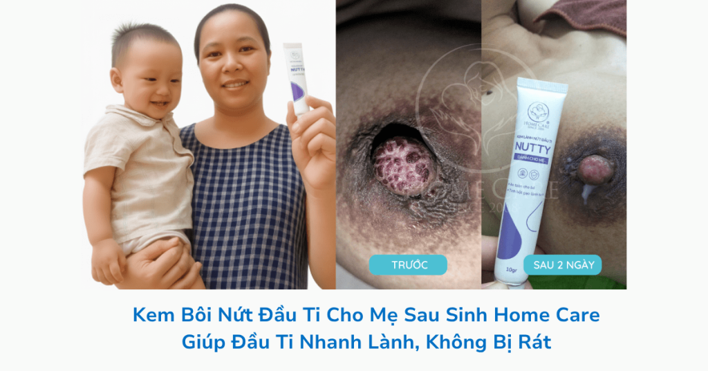 kem-boi-nut-dau-ti-kem-nutty-cho-me-sau-sinh-min