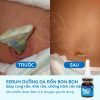 serum-duong-ron-cho-be-serum-cham-soc-ron-ve-sinh-ron-cho-be-bonbon-cua-homecare-a3