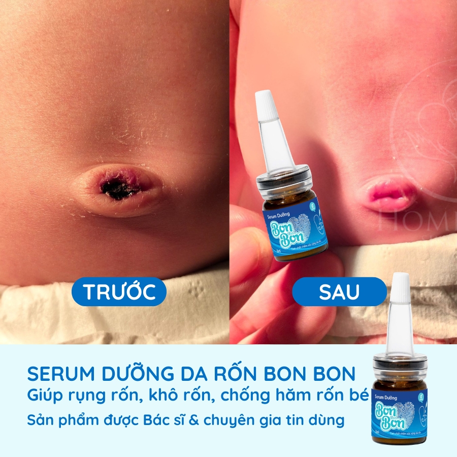serum-duong-ron-cho-be-serum-cham-soc-ron-ve-sinh-ron-cho-be-bonbon-cua-homecare-a4