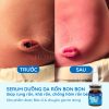serum-duong-ron-cho-be-serum-cham-soc-ron-ve-sinh-ron-cho-be-bonbon-cua-homecare-a5