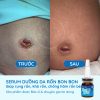 serum-duong-ron-cho-be-serum-cham-soc-ron-ve-sinh-ron-cho-be-bonbon-cua-homecare-a6