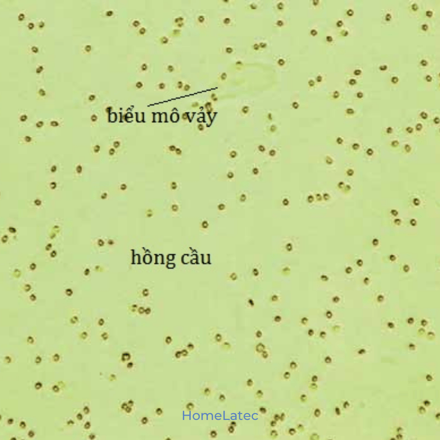 xet-nghiem-nuoc-tieu-5