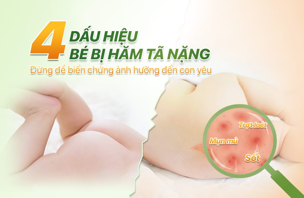 Dấu hiệu bé bị hăm tã nặng: Khi nào vết hăm trở nên nguy hiểm? Dấu hiệu bé bị hăm tã nặng: Khi nào vết hăm trở nên nguy hiểm?