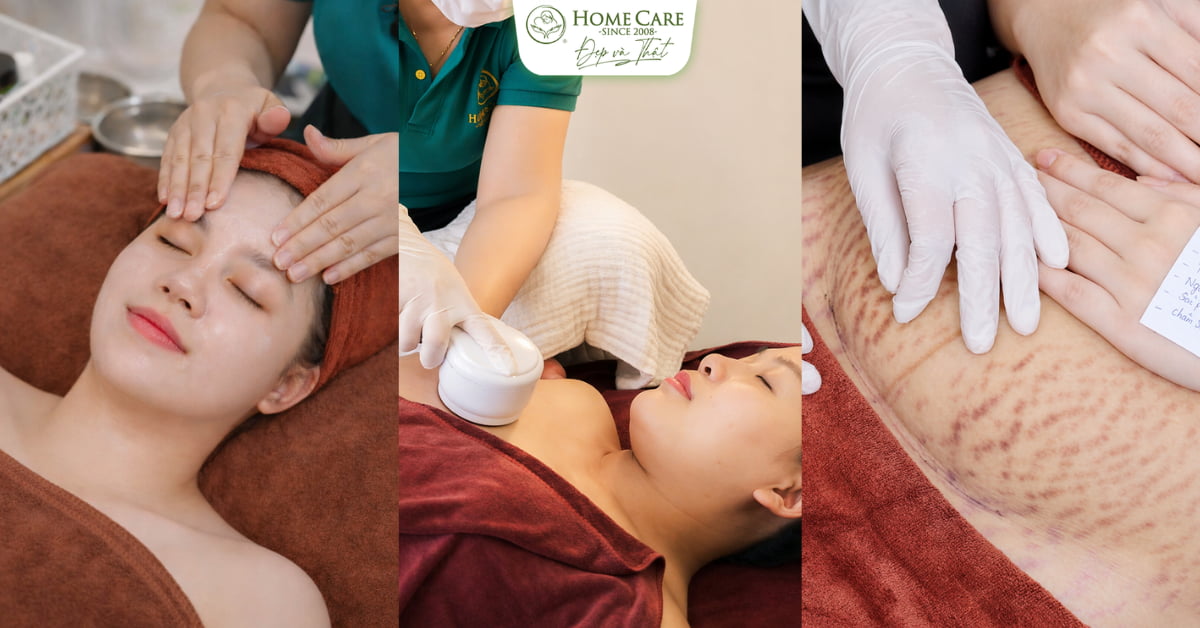 Chăm sóc mẹ sau sinh toàn diện tại Home Care