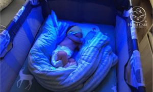 Cách nhận biết và cải thiện vàng da ở trẻ sơ sinh Cách nhận biết và cải thiện vàng da ở trẻ sơ sinh