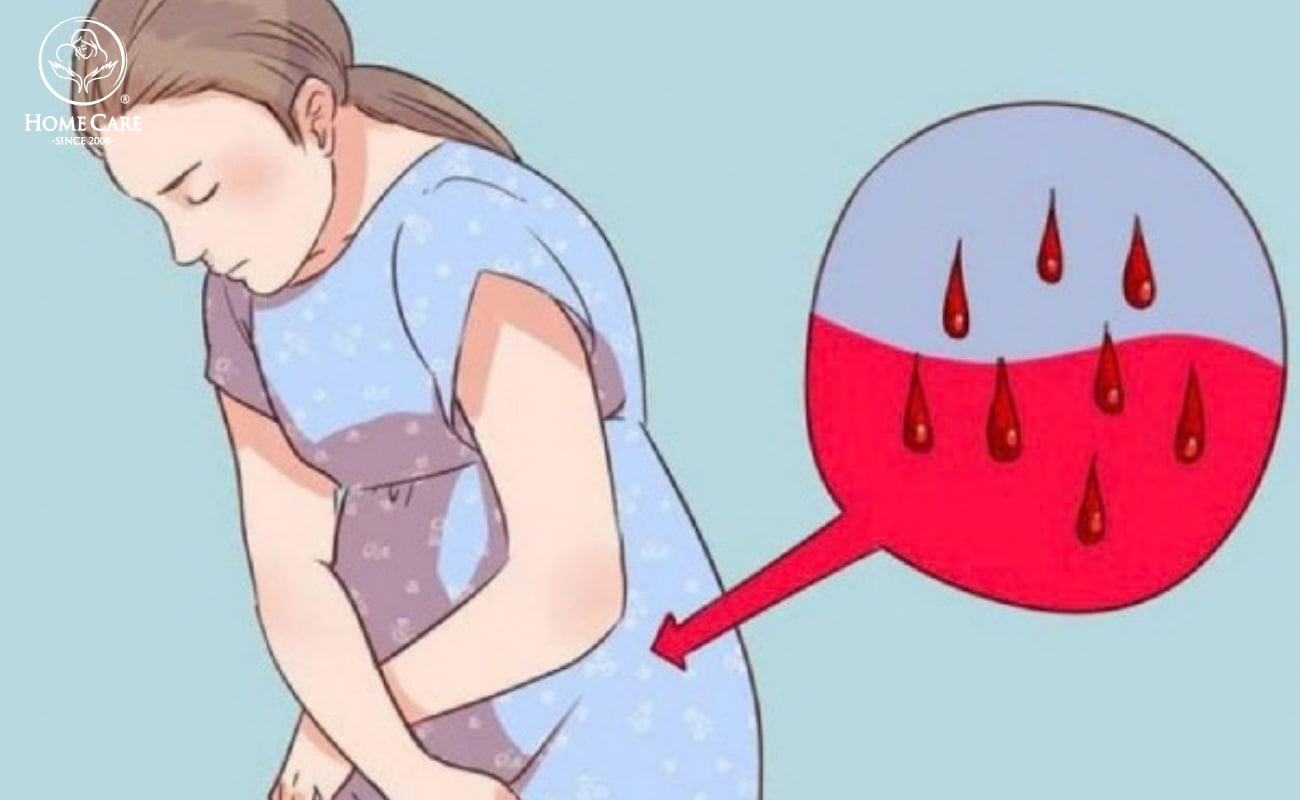 Sản dịch sau sinh là gì và vì sao cần tống ra nhanh?