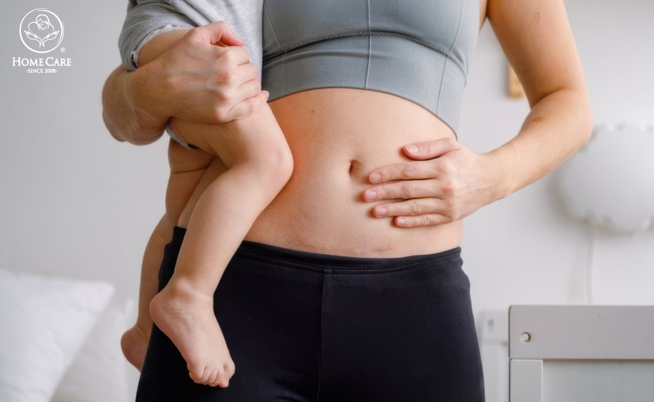 Vì sao tư thế nằm lại quan trọng với mẹ sinh mổ?