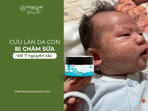 Chàm Sữa Bôi Gì? Gợi Ý Kem Bôi Cho Bé Được Chuyên Gia Tin Dùng Chàm Sữa Bôi Gì? Gợi Ý Kem Bôi Cho Bé Được Chuyên Gia Tin Dùng