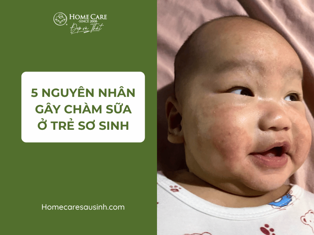 Chàm Sữa Do Đâu? Nguyên Nhân & Cách Chăm Sóc Da Cho Bé