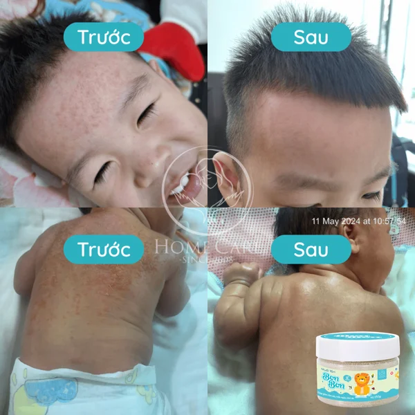  Muối tắm thảo mộc cho bé Bon Bon 
